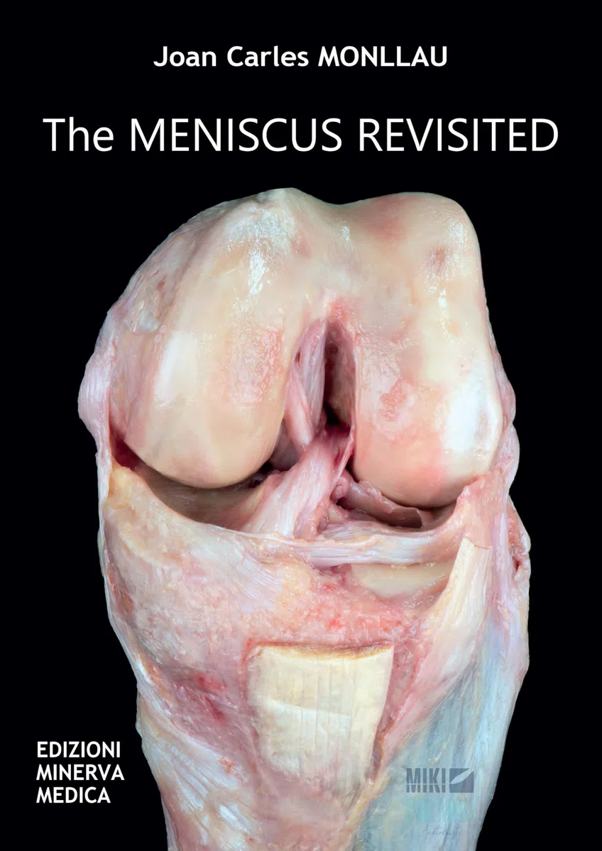 The meniscus revisited